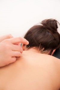Akupunktur lindert die Angst und die Schmerzen waehrend der Schwangerschaft.